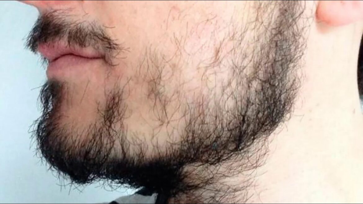 Falhas na barba? Veja 4 Dicas para ter a Barba Cheia